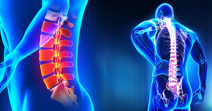 Tuổi tác là một trong những nguyên nhân chính gây ra tình trạng thoát vị đĩa đệm