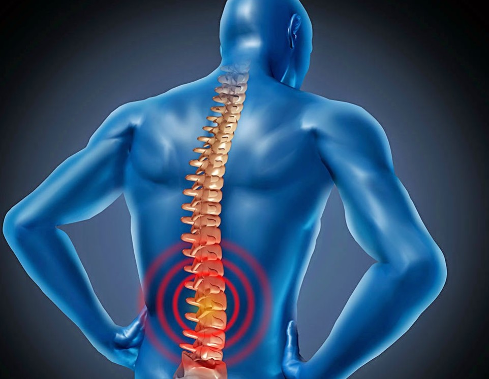 Thoái hóa cột sống ảnh hưởng lớn tới khả năng vận động
