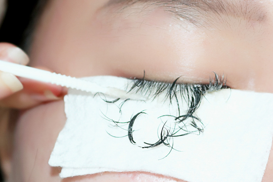 Có rất nhiều nguyên nhân dẫn đến việc tháo mi