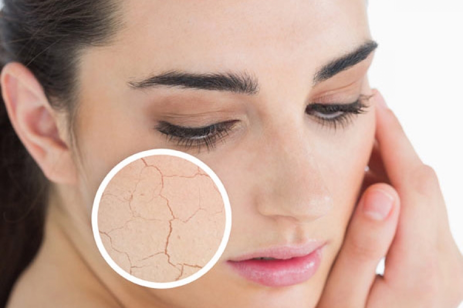 Da bị mụn cần lưu ý trường hợp không nên tẩy tế bào chết