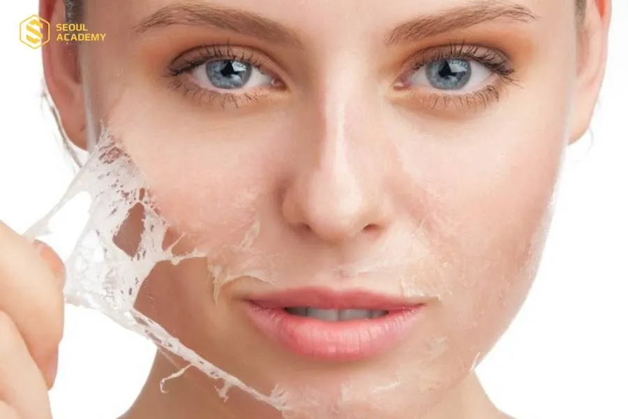 Tần suất peel tùy còn tùy vào tình trạng da và mục đích điều trị của mỗi người