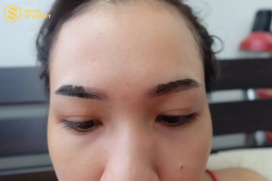 Dấu hiệu bong tróc lông màu từ 3-5 ngày sau phun xăm