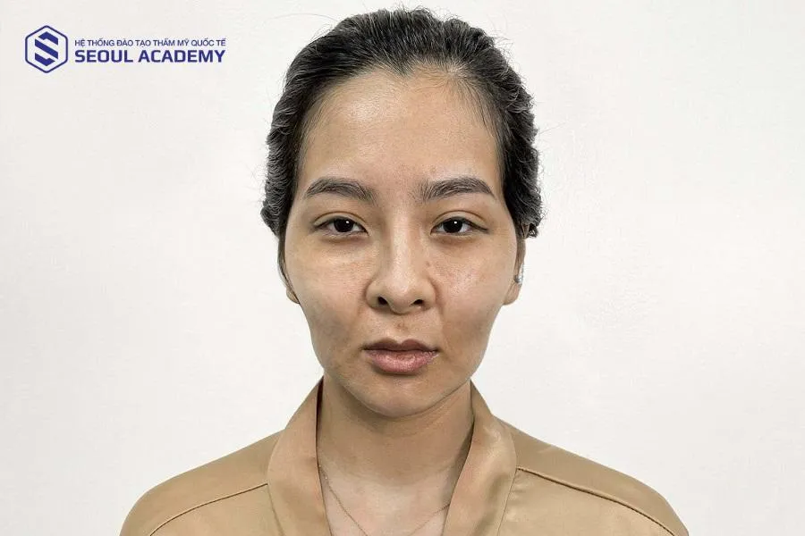 Mặt thỏ mỏ dơi là tướng mặt khá hiếm gặp trong nhân tướng học Á Đông