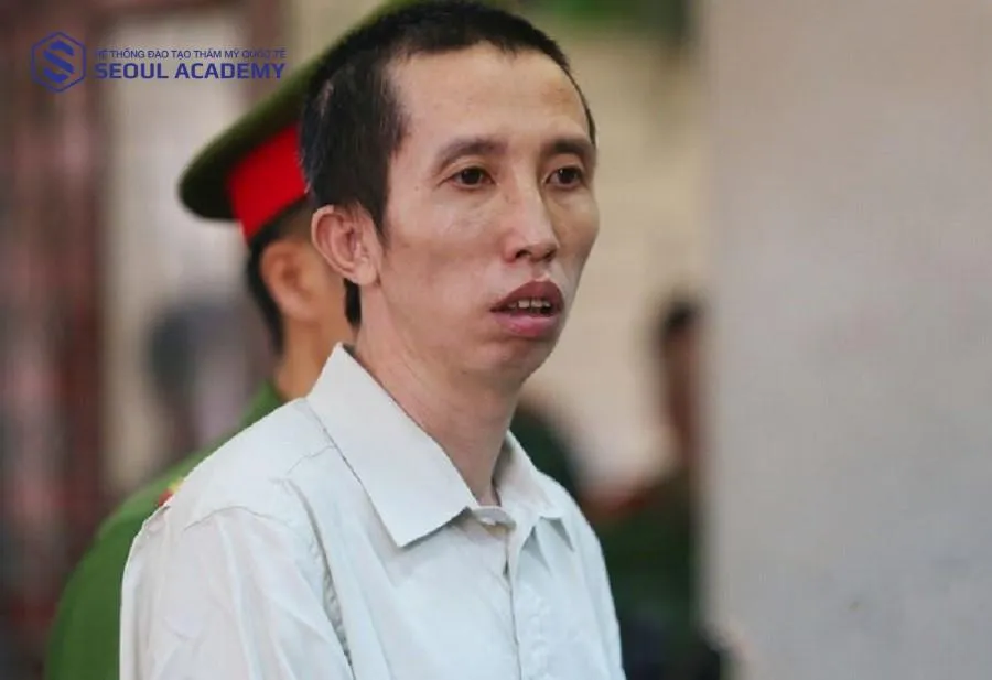 Tướng mặt thỏ mỏ dơi không được đánh giá cao trong nhân tướng học ở nam giới