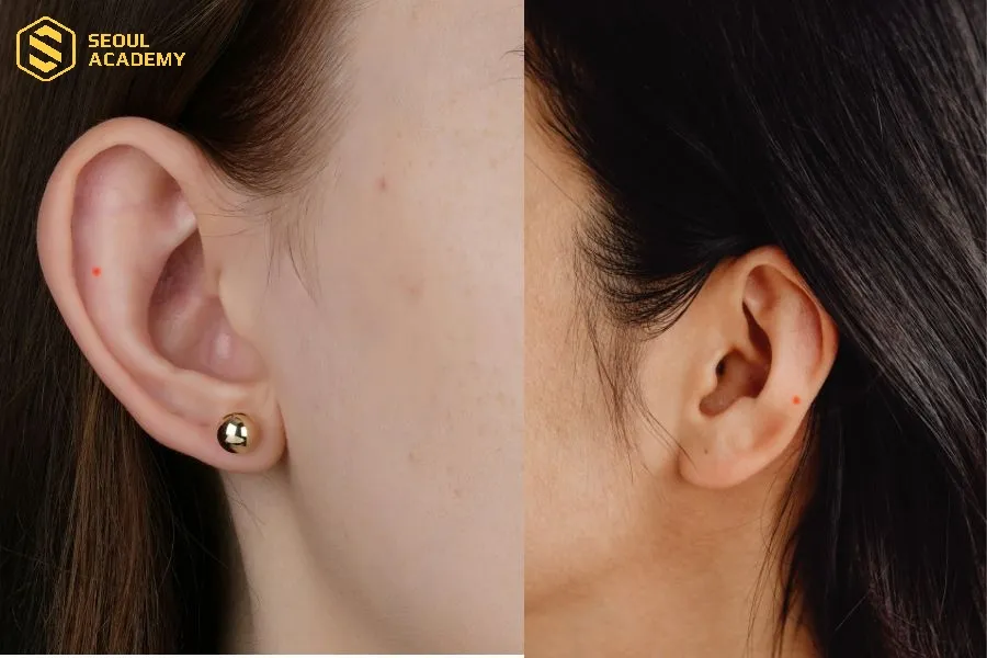 Nốt ruồi son ở tai mang đến sự may mắn cho phúc khí và tuổi thọ của chủ sở hữu
