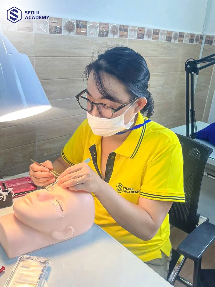 Thực hiện kỹ thuật tách mi chuẩn và lấy keo chuẩn