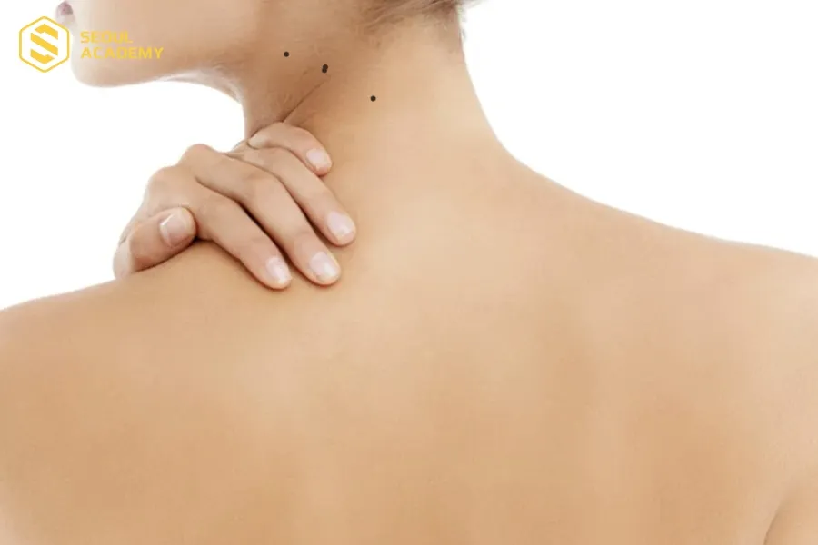 Nốt ruồi thẳng hàng ở cổ về vận số khá tốt Nốt ruồi thẳng hàng ở cổ về vận số khá tốt