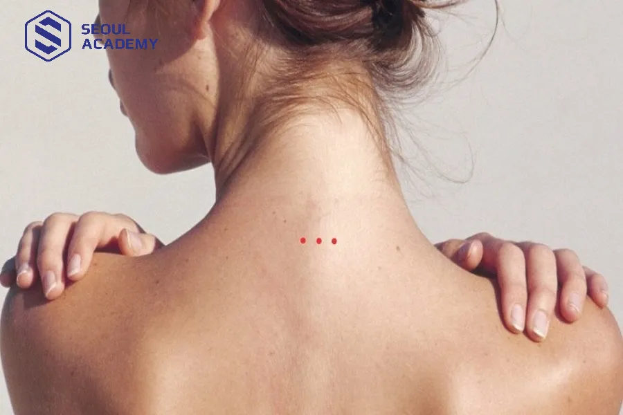 Nốt ruồi sau gáy nữ được xem là nốt ruồi đại phú quý