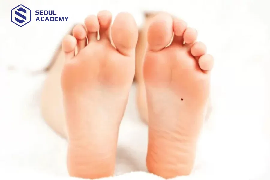 Nốt ruồi phú quý nữ ở lòng bàn chân