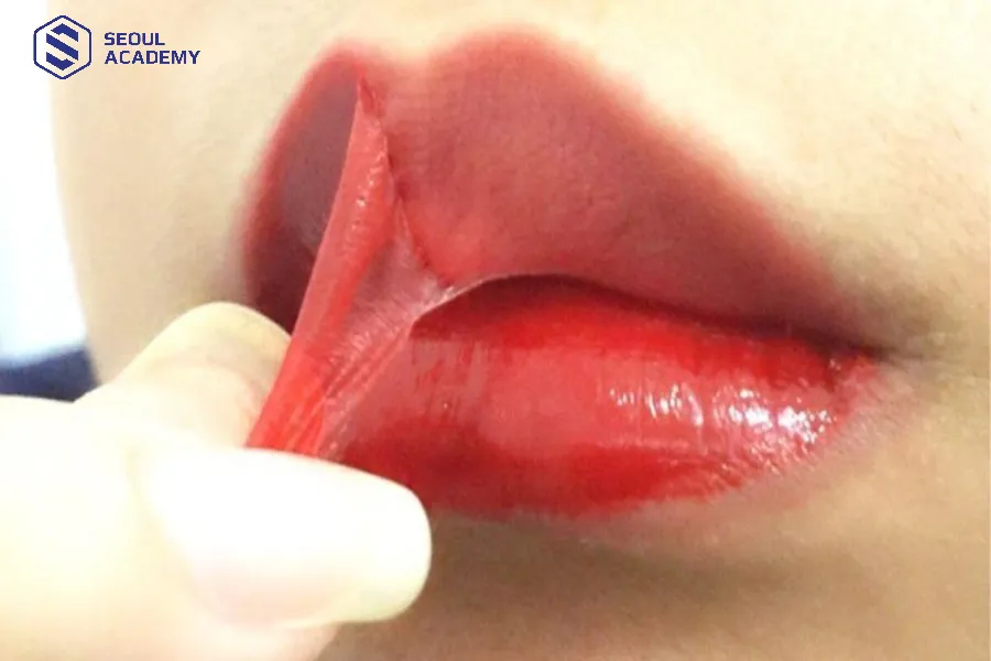 Môi sau khi khử và môi đã bong ra có màu tương tự nhau
