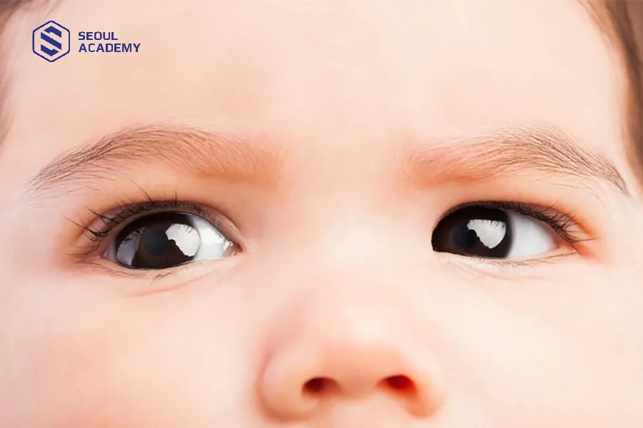 Trẻ sơ sinh có khoảng 150 sợi mi Trẻ sơ sinh có khoảng 150 sợi mi