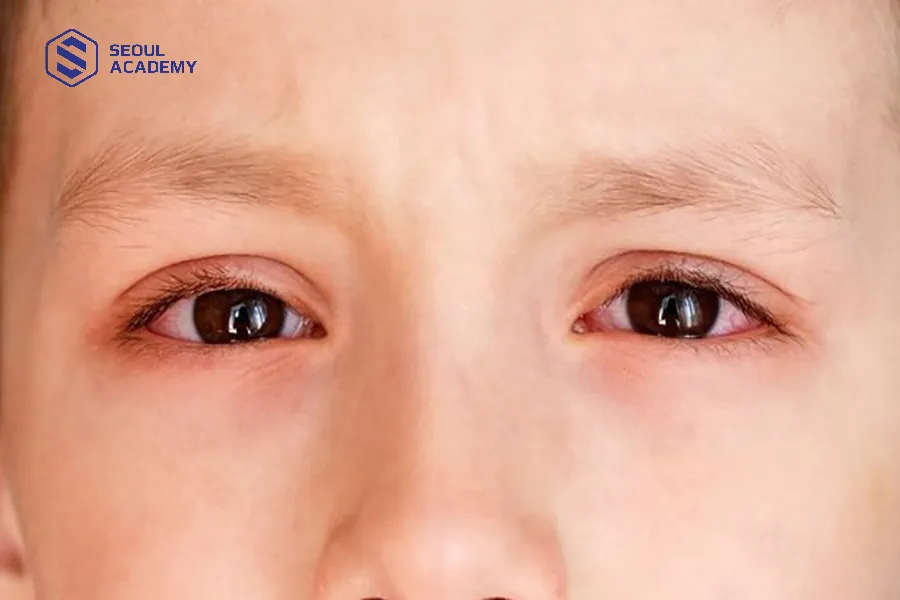 Cắt lông mi không giúp mi của trẻ sơ sinh dài hơn