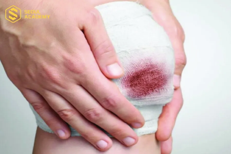 Không nên để chảy máu trong ngày mùng 1