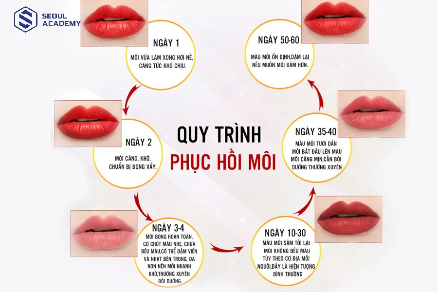 Quá trình phục hồi cơ bản sau phun môi