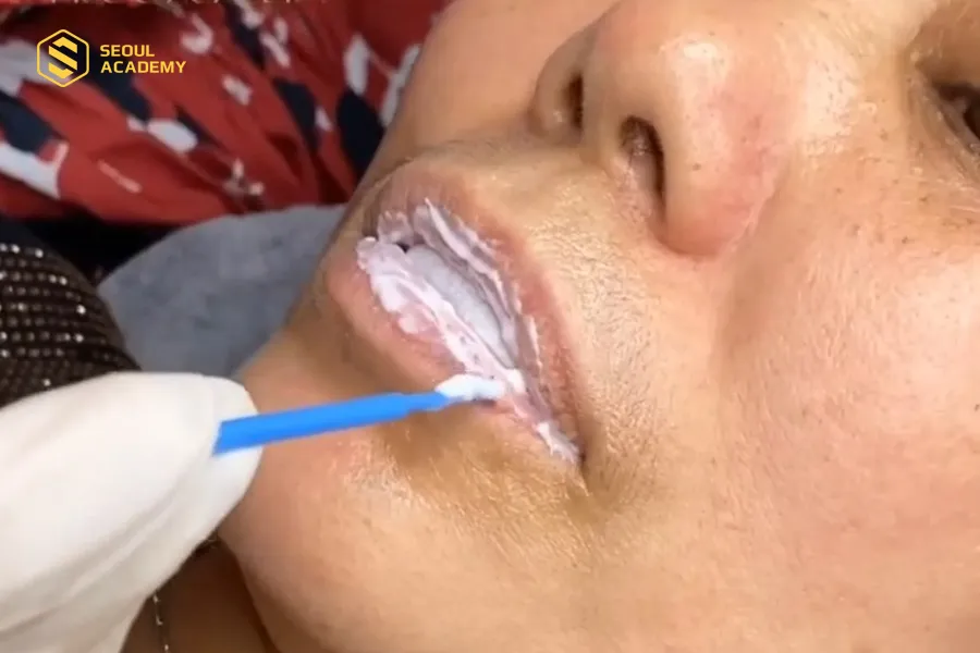 Thuốc tê xăm môi là sản phẩm giúp giảm cảm giác đau đớn, khó chịu trong quá trình phun xăm môi