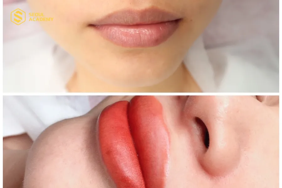 Tình trạng môi trước và sau khi xăm