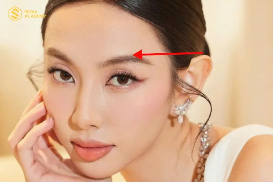 Tai cao hơn lông mày là đặc điểm của tướng tai giàu