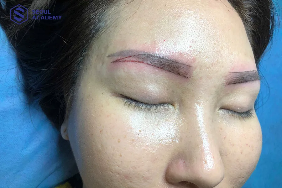 Chân mày bị lỗi là lý do khiến chị em đi xoá chân mày điêu khắc