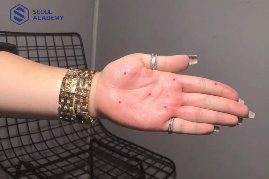 Nhiều bạn trẻ xăm nốt ruồi với mục đích đổi đời