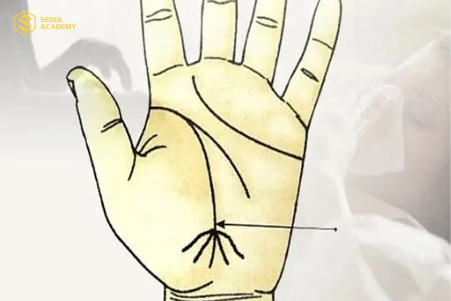 Đường sinh đạo nhiều vân tạp loạn