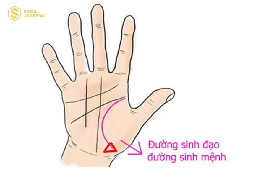 Các chỉ tay trên đường sinh đạo tạo thành hình tam giác