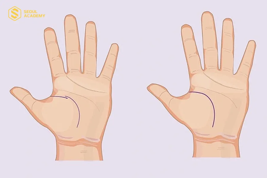 Không nên quá tin vào đường sinh mệnh đoản mệnh