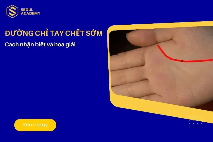 Đường chỉ tay chết sớm