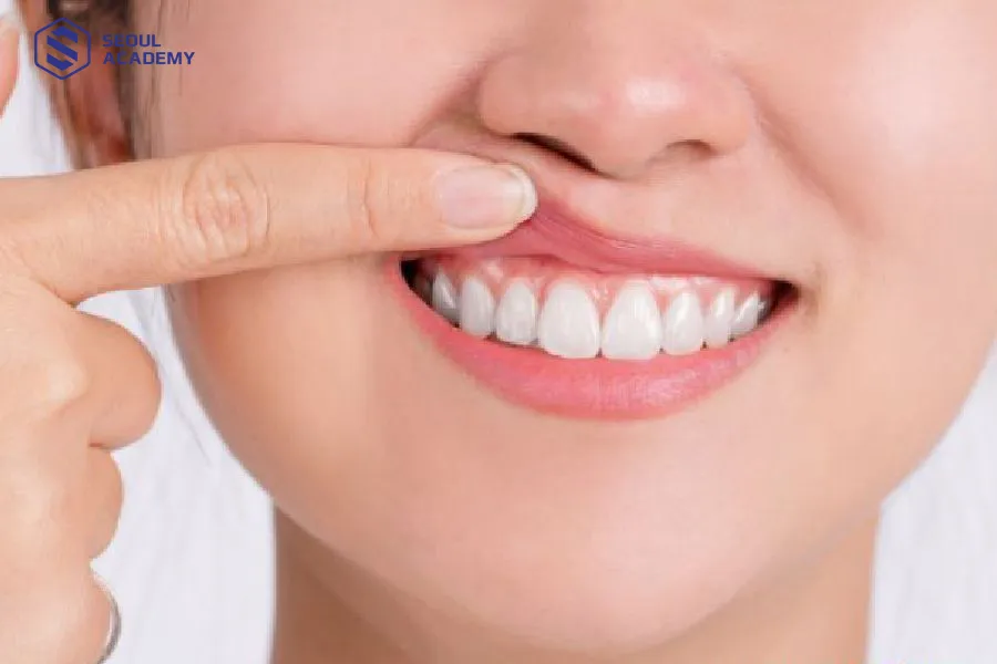 Điềm báo cho giật môi trên bên phải