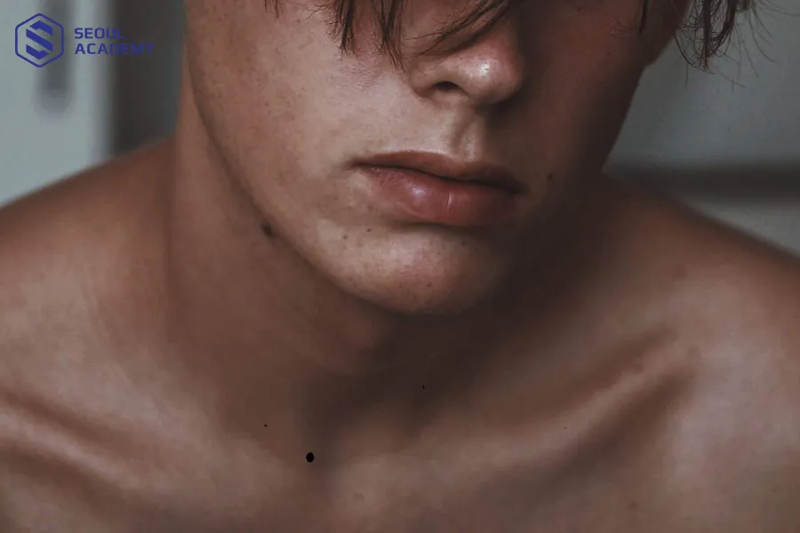 Nam giới có nốt ruồi ở xương quai xanh mọc lệch