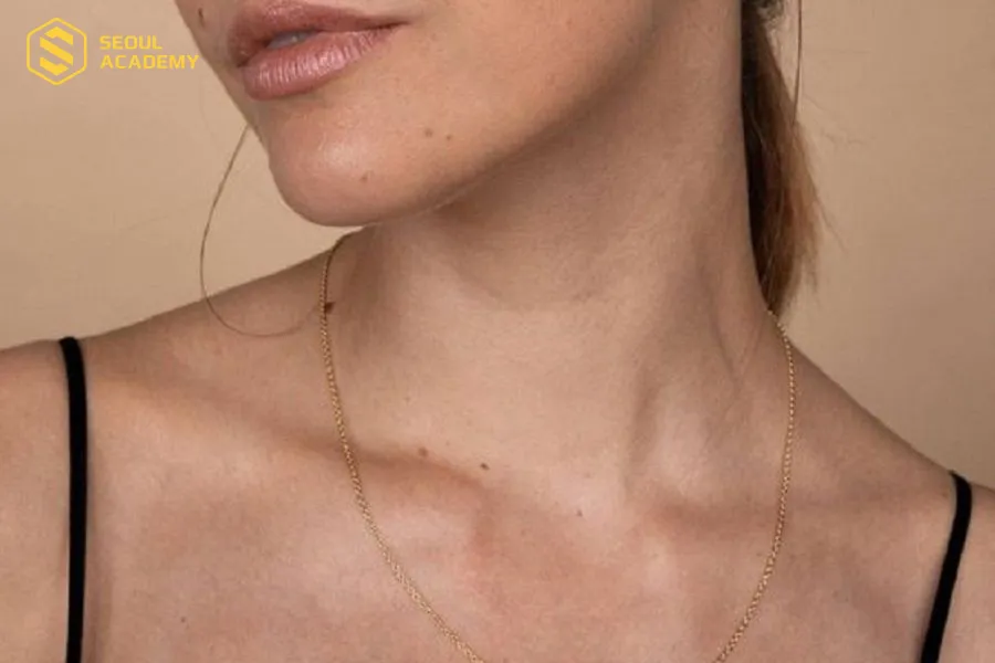 Nốt ruồi mọc lệch ở xương quai xanh