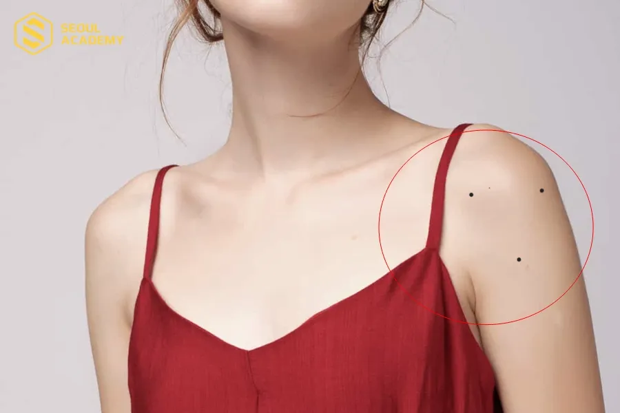 3 nốt ruồi tạo thành hình tam giác