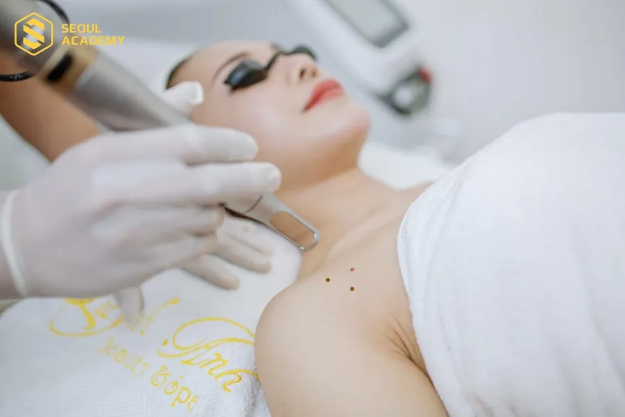Kỹ thuật xoá nốt ruồi bằng laser vô cùng hiện đại