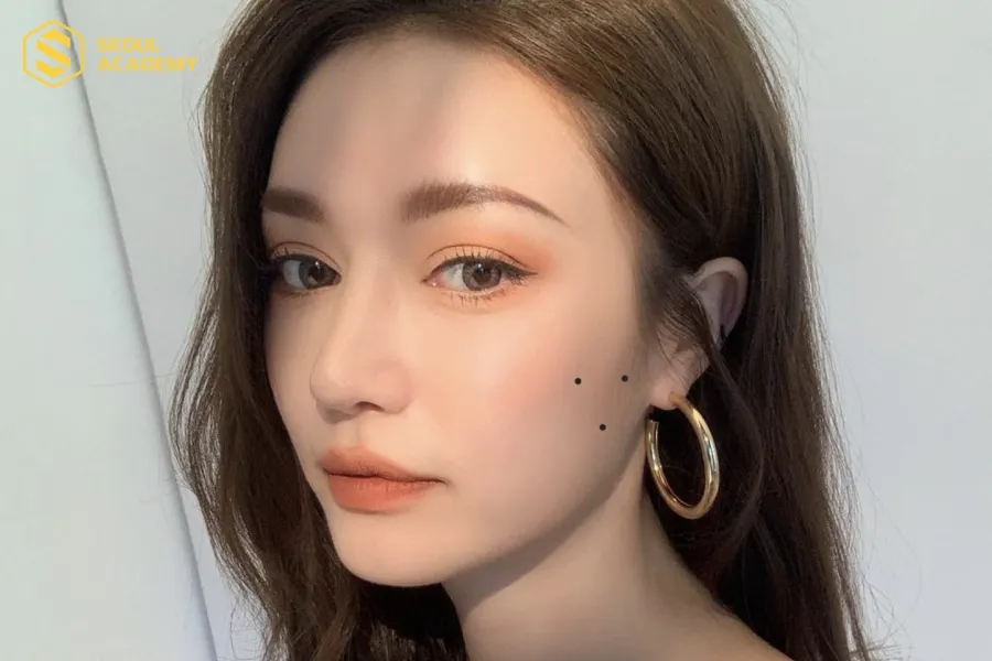 Nhiều người sở hữu nốt ruồi tam giác trên mặt