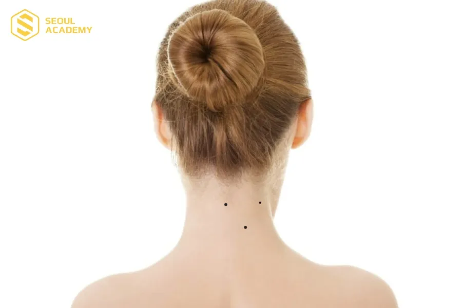 Vận số người nốt ruồi tam giác sau gáy khá tốt