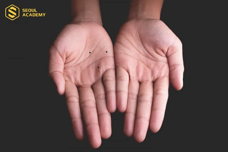 Người có nốt ruồi tạo hình tam giác bàn tay vận số khá tốt