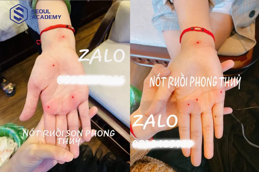 Dịch vụ xăm nốt ruồi được quảng cáo rất nhiều trên mạng