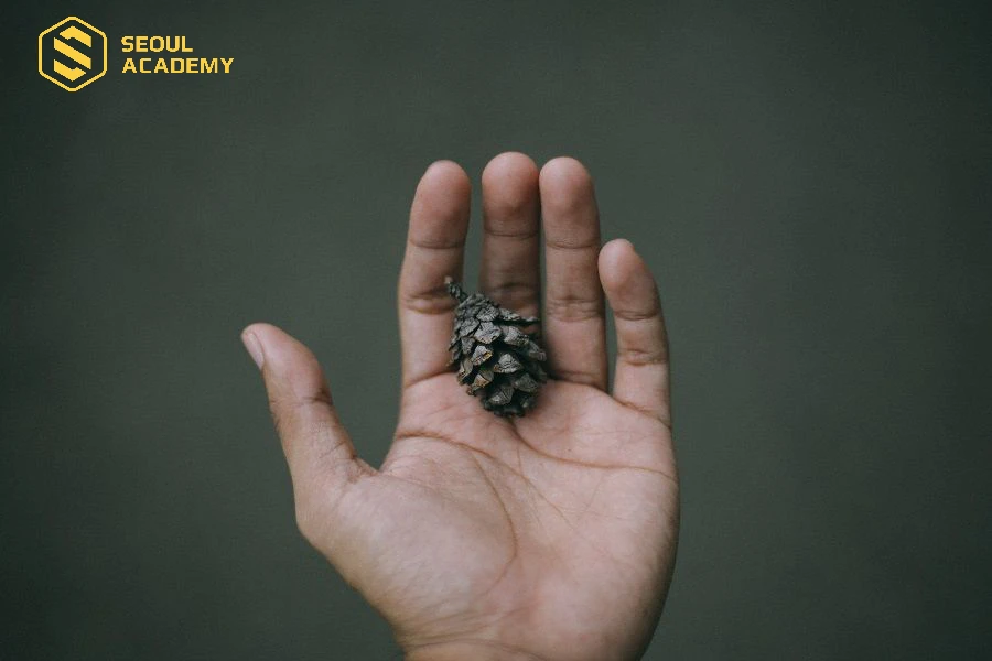 Bàn tay hình chữ M hiếm có trên thế giới