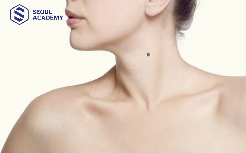 Nốt ruồi bên cổ có thể báo hiệu cuộc sống nhiều khó khăn