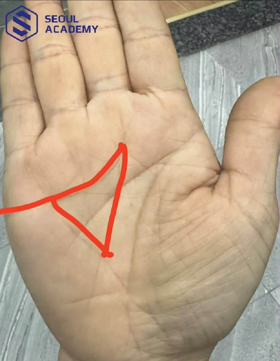 Có rất nhiều người thường hay bị nhầm lẫn giữa cờ lệnh và nhiều hình thái khác trong lòng bàn tay