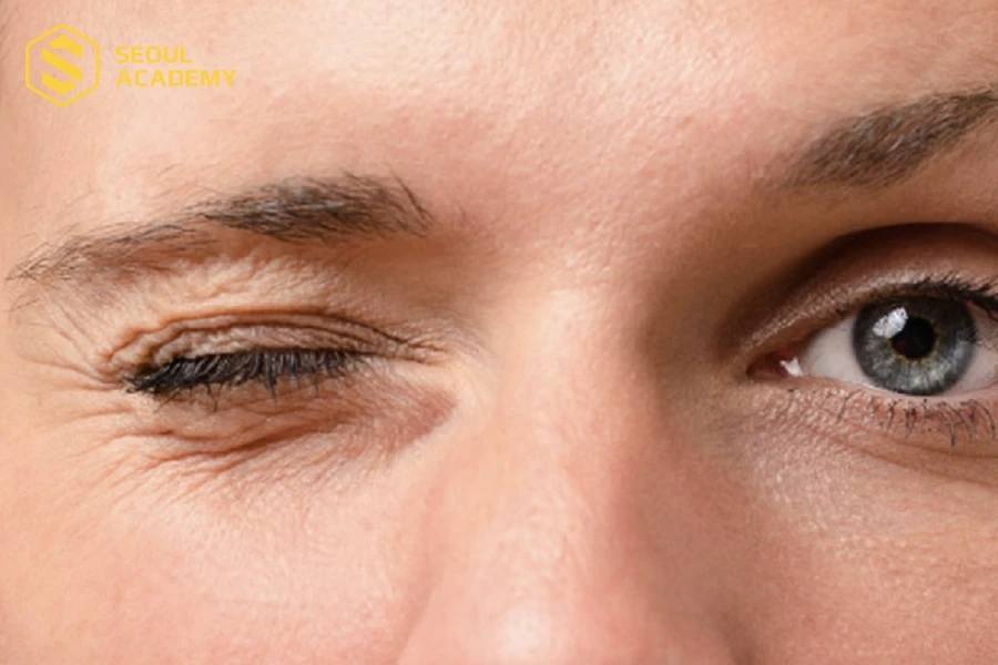 Thử nháy mắt thường xuyên để giúp mắt đẹp hơn