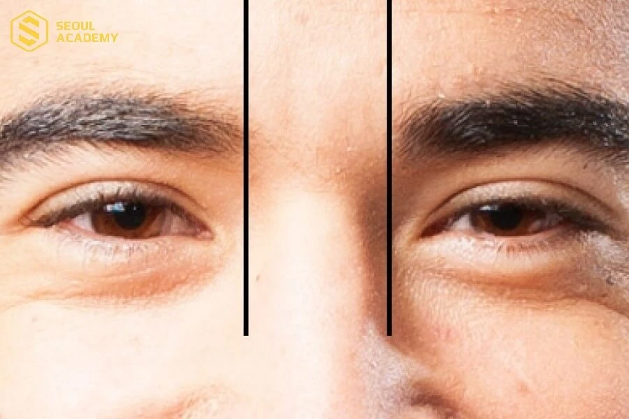 Bạn có thể lựa chọn phun xăm thẩm mỹ để giúp sở hữu dáng mày rậm rạp hơn nhanh chóng, hiệu quả cao