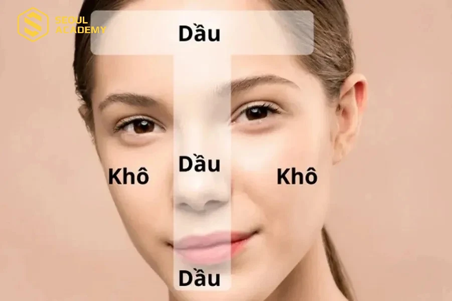 Da hỗn hợp có sự pha trộn vùng da dầu ở khu vực chữ T và khô ở vùng chữ U