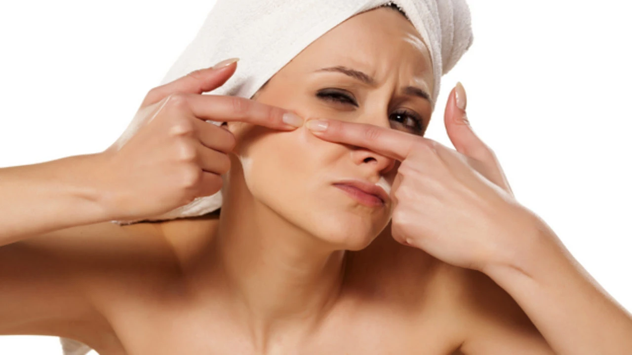 Tránh chạm tay vào nốt mụn sau nặn để hạn chế kích ứng, viêm nhiễm