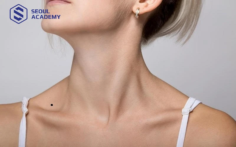 Nốt ruồi ở cổ thể hiện sự may mắn