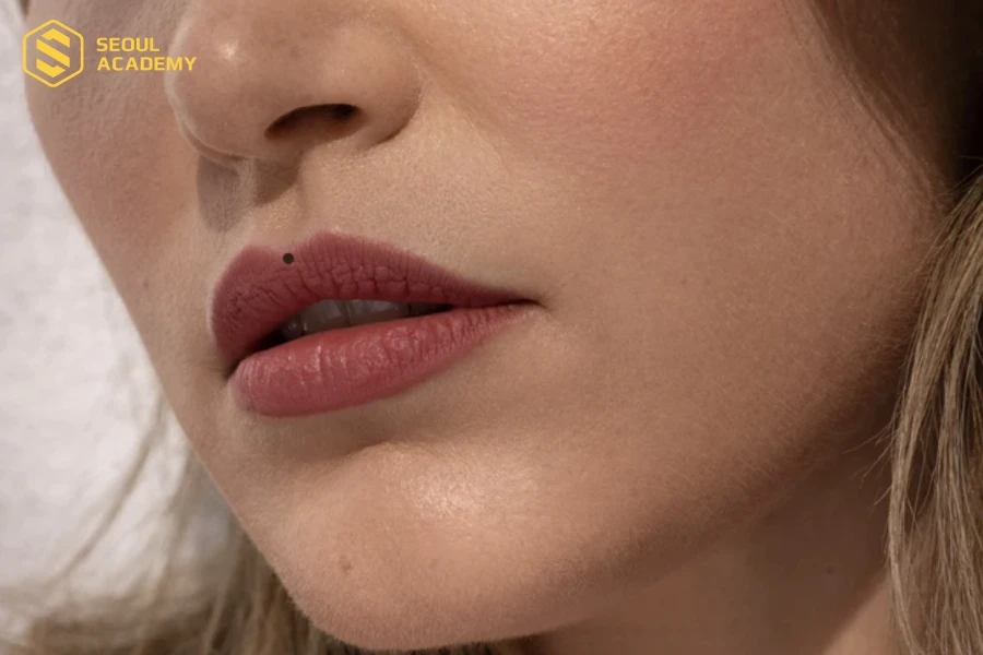 Trên khuôn mặt có nhiều nốt ruồi tốt cho nữ không nên xoá