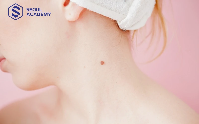 Nốt ruồi son ở cổ thể hiện cuộc sống sung túc