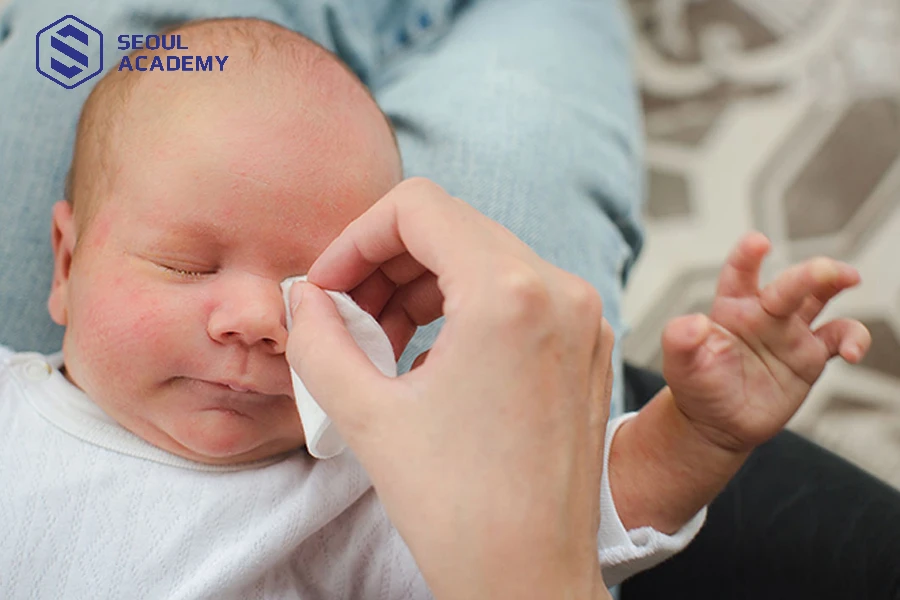 Chú ý giữ vệ sinh vùng mắt và lông mi cho trẻ