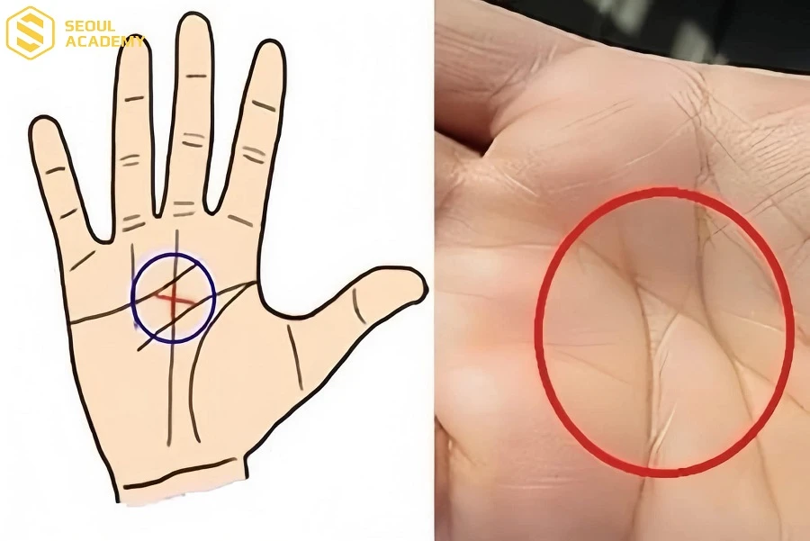 Đường chỉ tay chữ thập và chữ X có sự khác nhau về vị trí giao cắt các đường chỉ tay khác