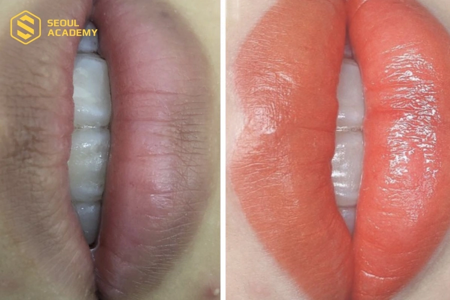 Mực xăm trắng giúp khử thâm viền môi hiệu quả