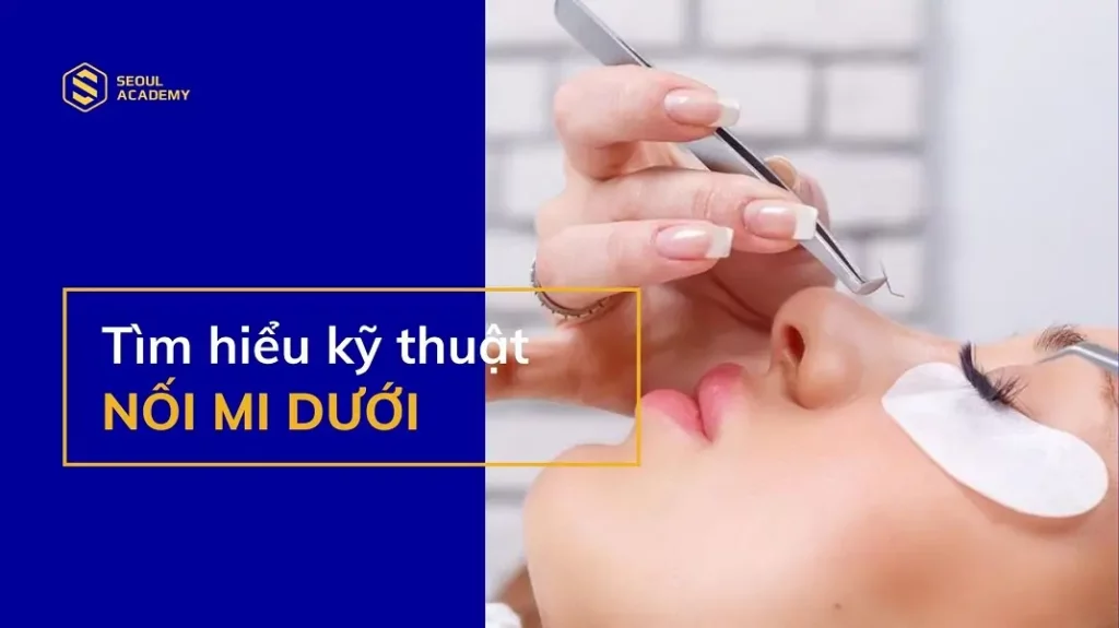 kỹ thuật nối mi dưới